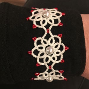 Armband "Summerlove" – Bild 2
